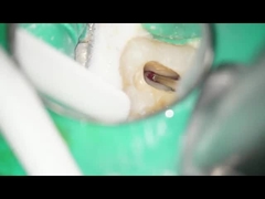 فرزهای RA دندانپزشکی فرزهای کاربید تنگستن دندان استفاده از سرعت کم